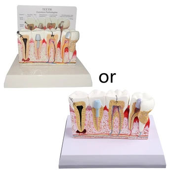 Эндодонтическая модель размером 7x5,9x5,1 дюйма для обучения модели зубов Study Teach