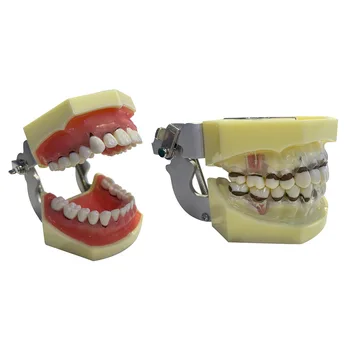Модель зубов Модель упражнений для пародонта Патология полости рта Модель съемных зубов