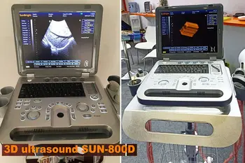Профессиональная диагностика системы, ультразвук, черно-белый ультразвук, 3D ультразвуковой аппарат для ноутбука