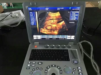Профессиональная диагностика системы, ультразвук, черно-белый ультразвук, 3D ультразвуковой аппарат для ноутбука
